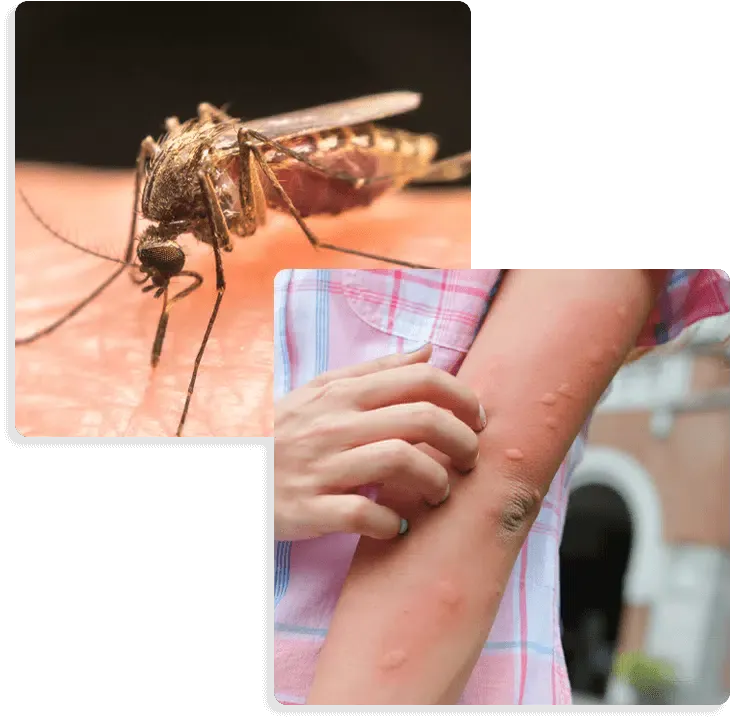 zanzare e punture di zanzare